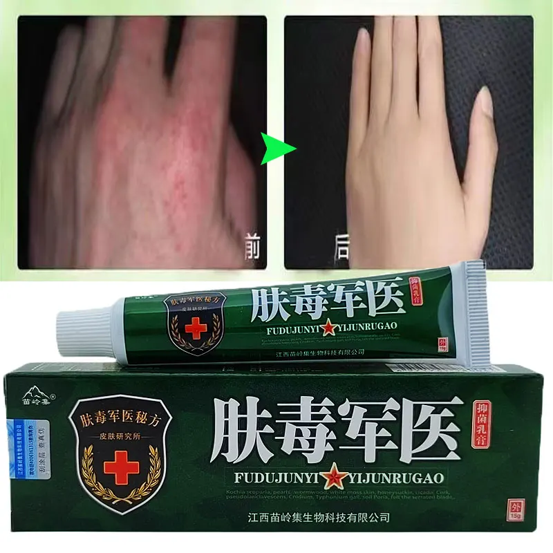 

Psoriasis Urticaria Antibacterial Cream Herbal Anti-itch Acne Relief Seborrheic Dermatitis Rash Treatment Health Skin Care 15g