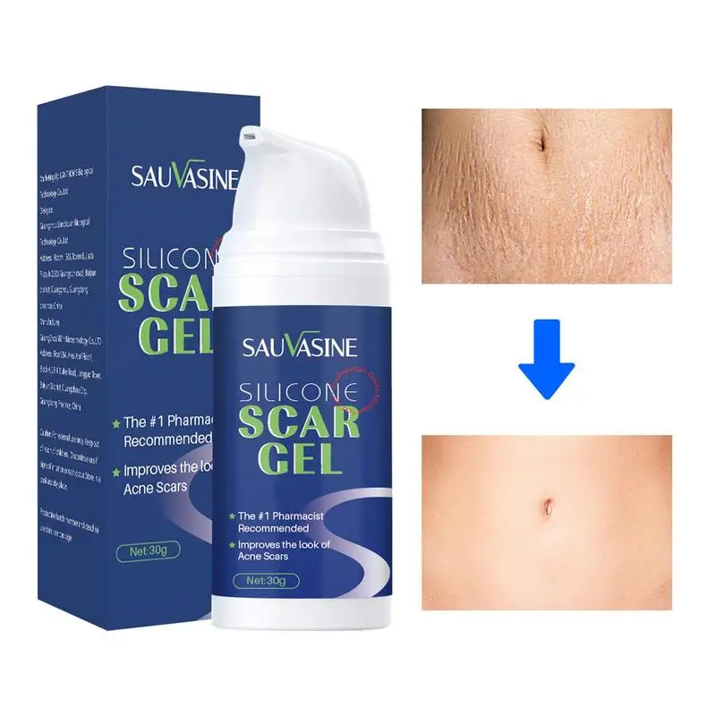 

Super Strong Scar Removal Cream For Old Scars Maternity Stretch Marks Gel Silicone Acne Scar Repair Fat Striae Treat Care 30g