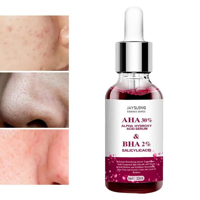 

Сыворотка для снятия красноты лица, сыворотка для удаления эритемы, жидкое увлажняющее эфирное масло для ухода за кожей, 30 мл