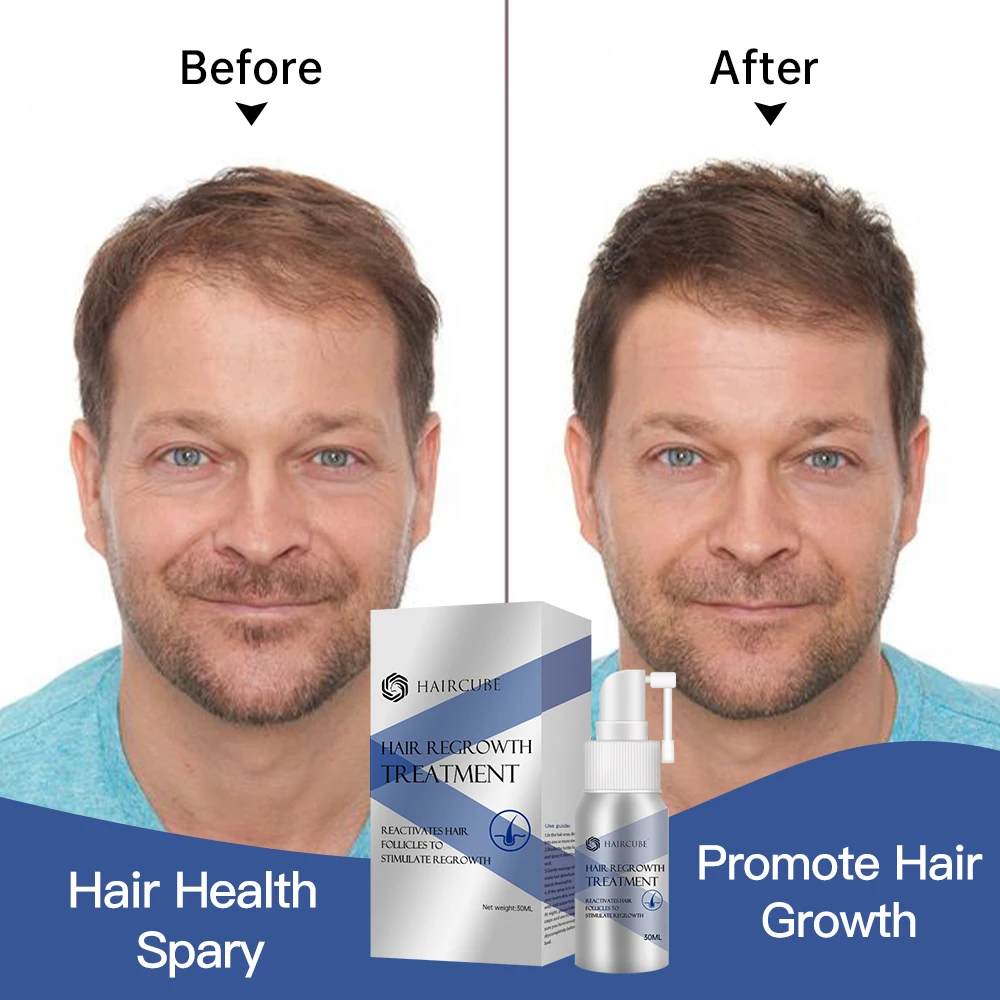 

HAIRCUBE Hair Growth Spray Herbal Hair Nourishing Serum for Men Strengthens Hair Roots Treatment Anti-Hair Loss Liquid Products