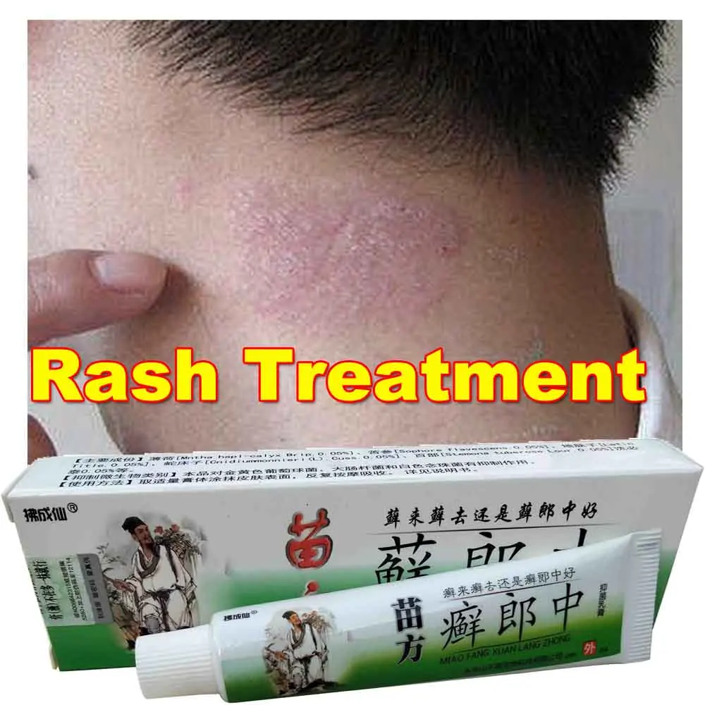 

Private Moist Rash Treatment Natural Chinese Herbal Eczema,Psoriasis Creams Dermatitis Pruritus Anti-Itch External Use Only XLZ
