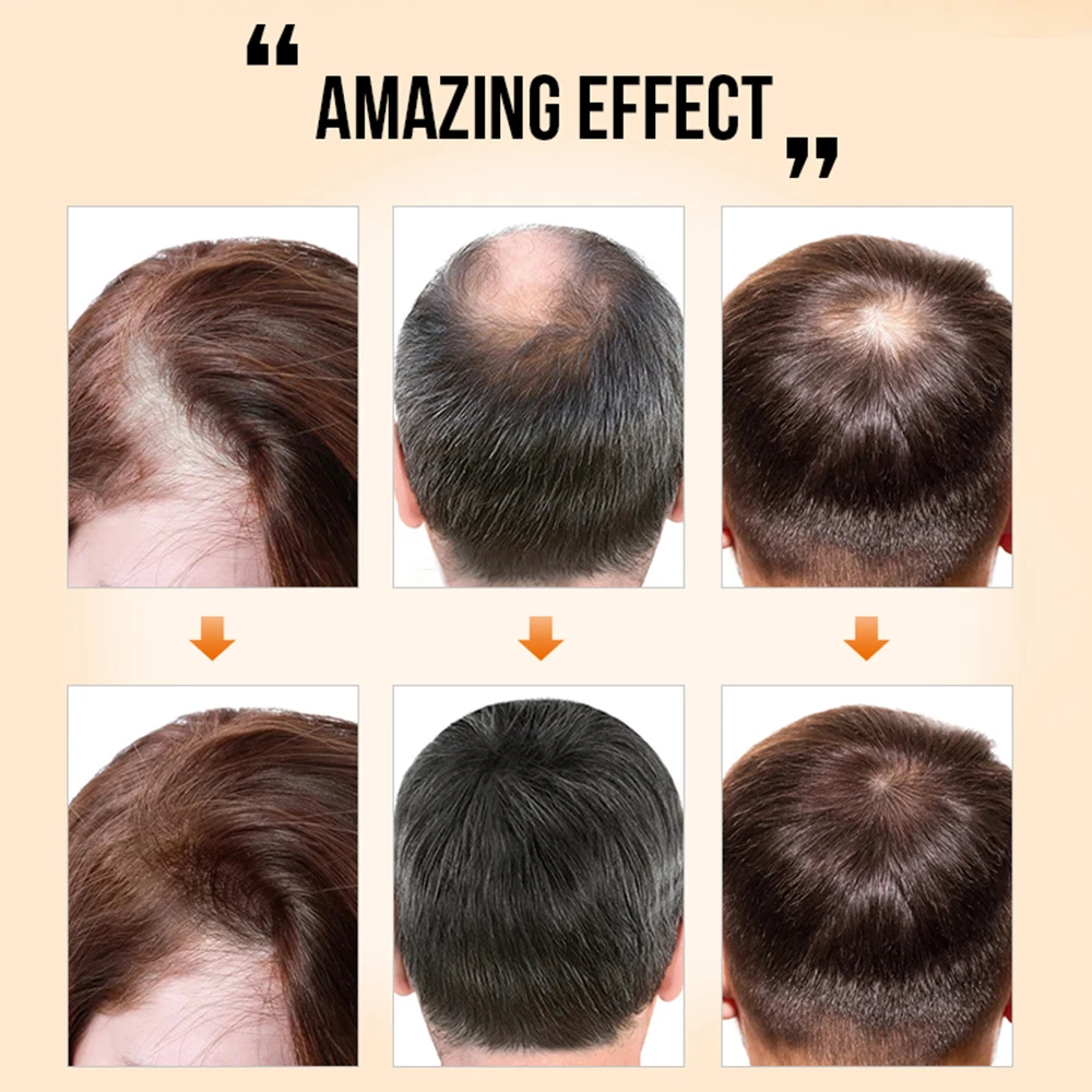 Продукция для роста волос эссенция быстрого масло предотвращения повреждения