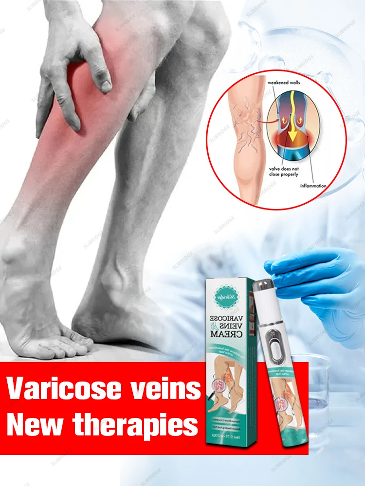 Крем-лазер Varicosse