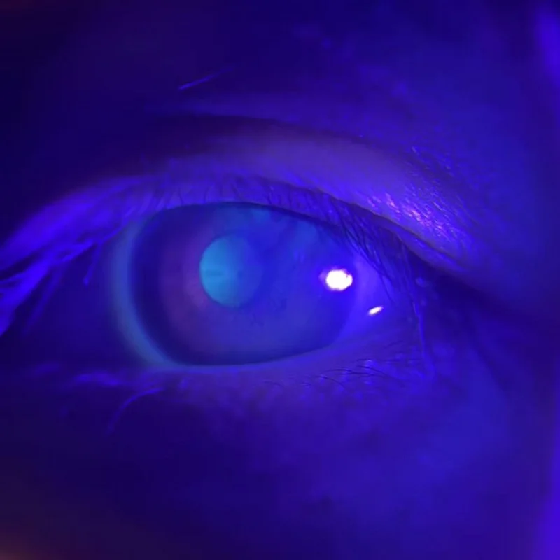 

Optometrial Простой Ирис Адаптер Камеры