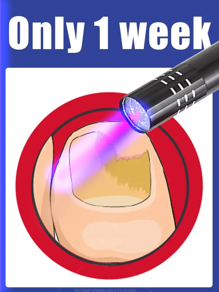 

Лазерный указатель Eelhoe для лечения онихомикоза