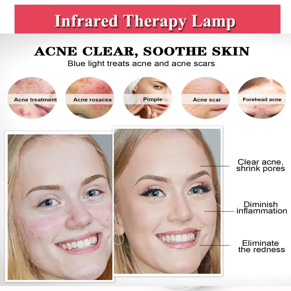 Синий и красный светодиодный светильник для лечения акне терапевтический