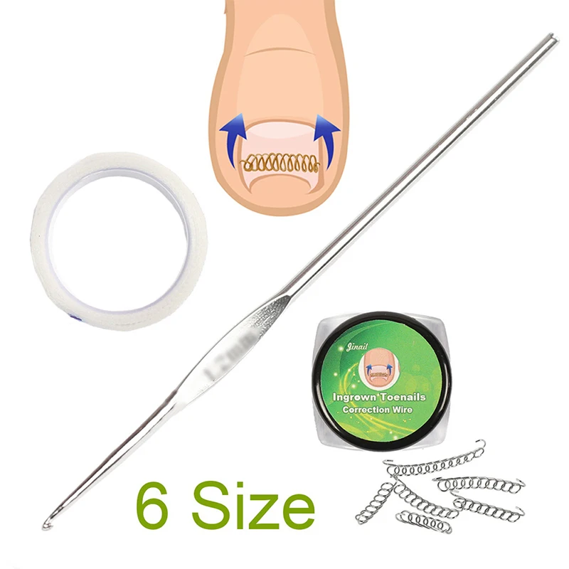 

8pcs/set Ingrown Toe Nail Correction Wire Fixer Pedicure Recover Paronychia Acronyx Onyxis Bunion Corrector Foot Care Tool