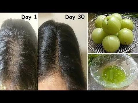Extreme Hair Growth Oil Chebe Extra Strength Formula with Amla Coconut for Receding Hairline DHT Blocker |