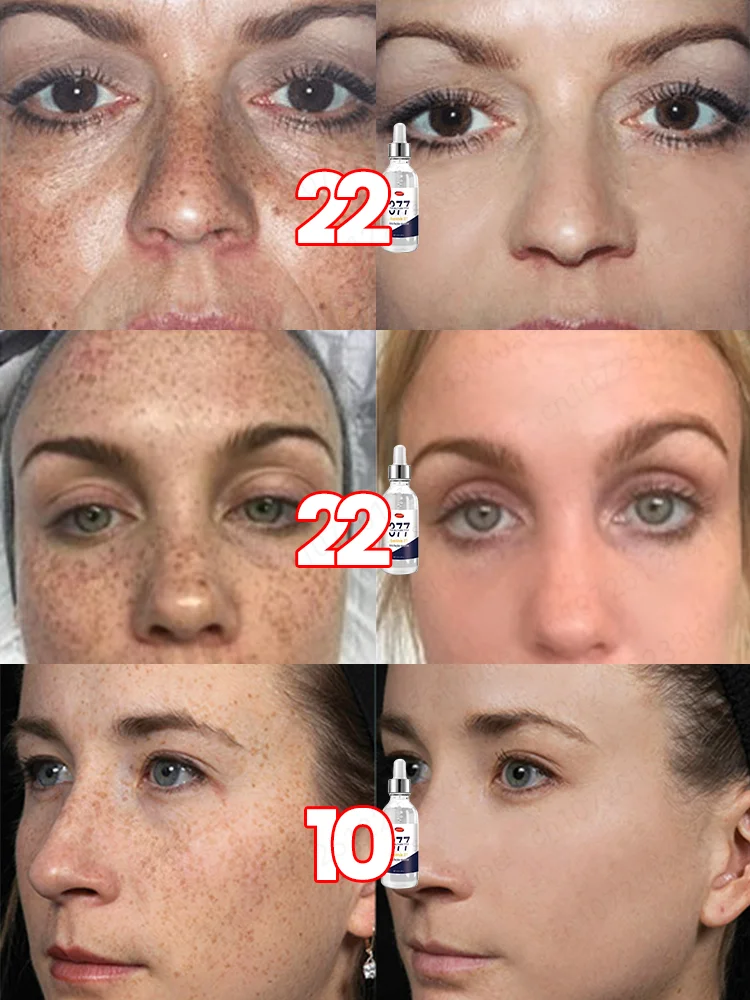 ʸ ᵒᵉ ᵉ ᵒ ˢ ᵃᵃᵃᵃᵃᵃᵃᵃ