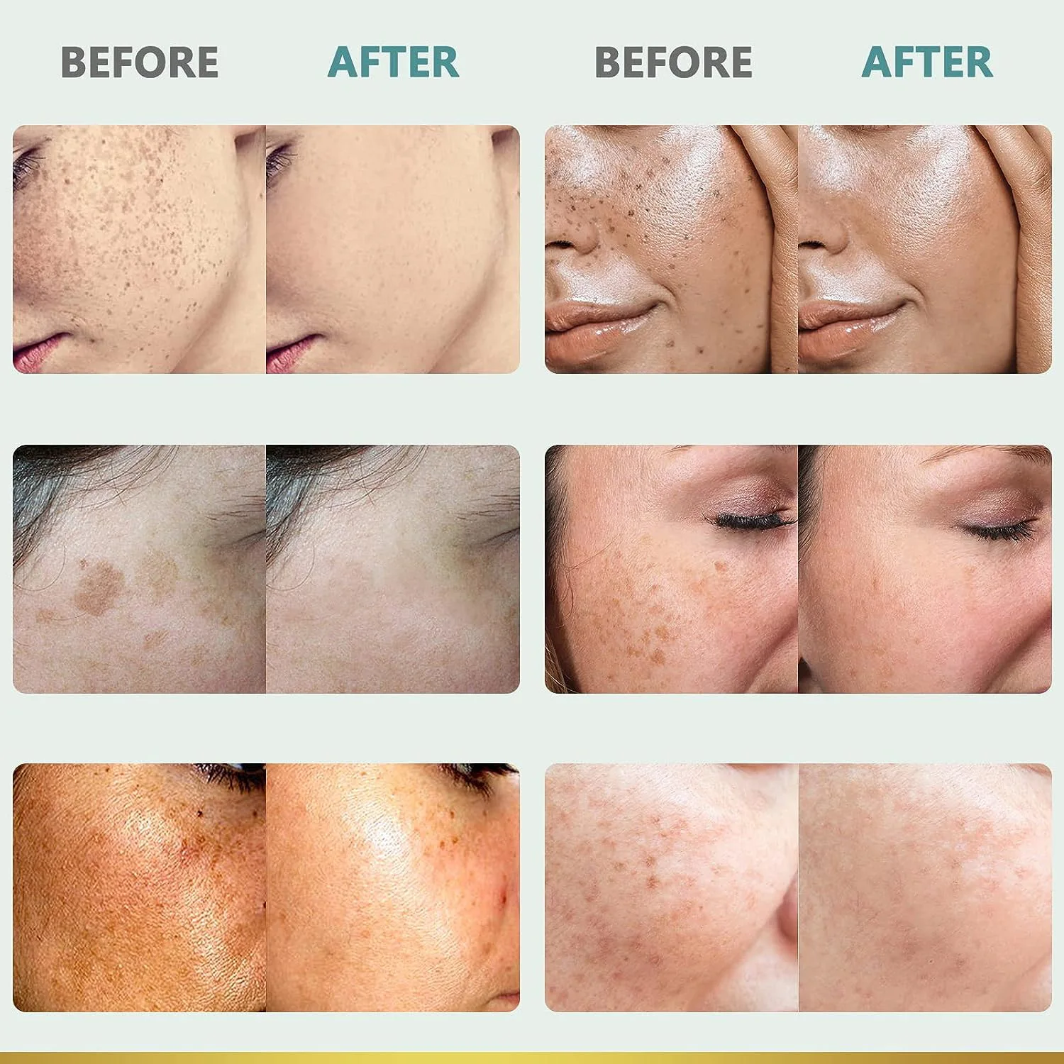 Антивозрастная сыворотка с витамином B3 Niacinamide отбеливание мелазма акне веснушек