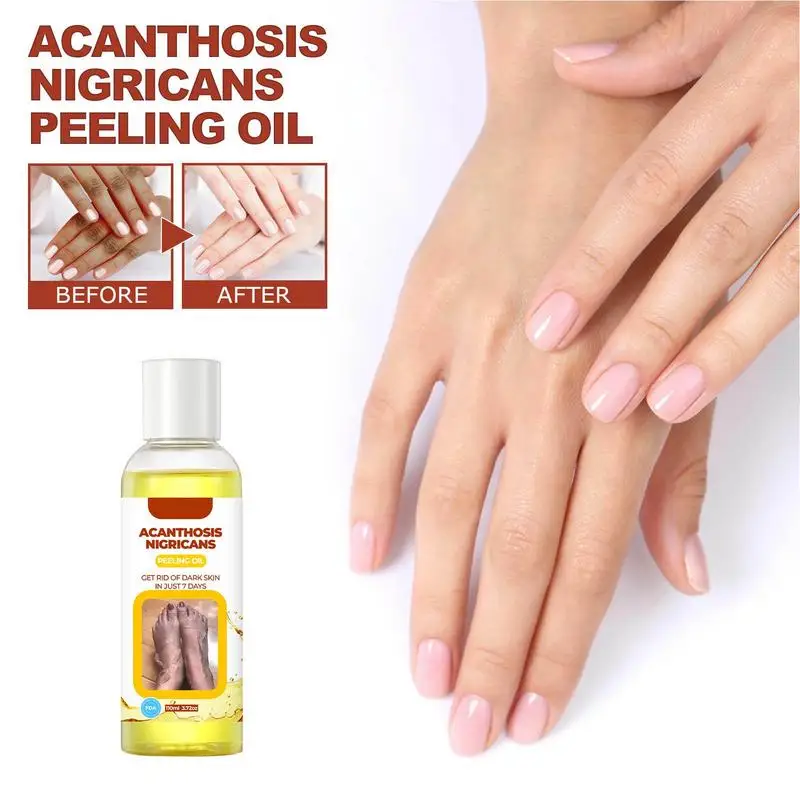 

110ml Peeling Oil Elbow Knee Finger Yellow Oil Skin Brightening Moisturizing Removes Dead Skin Peeling For Body Dark Spots