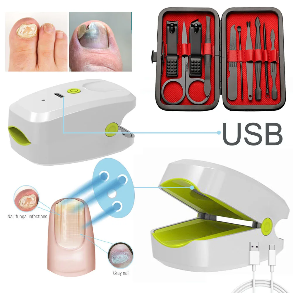 

Нм безболезненный лечебный инструмент для ногтей, лазерный Уход за ногами, отбеливание ногтей, удаление грибка, инфекция ногтей, терапевтич...