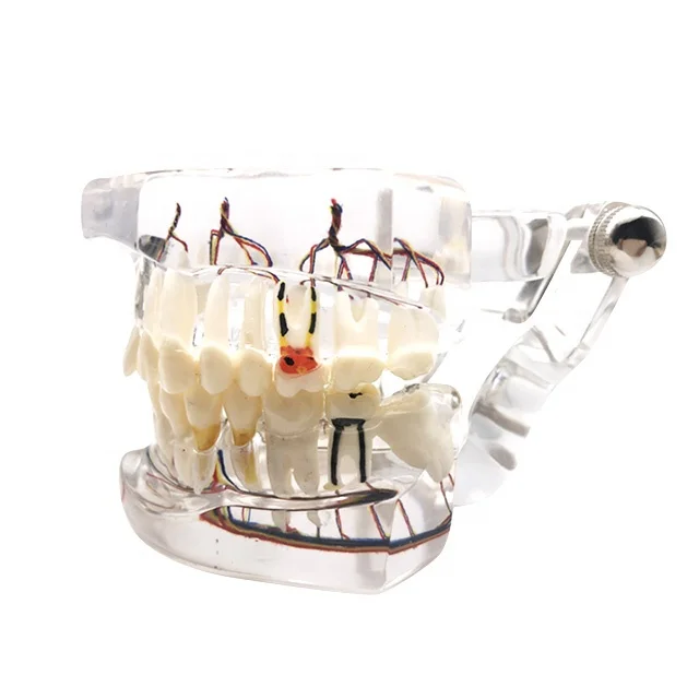 

HST-C15-01 Dental Implant Pathological Model With Nerve For Teaching