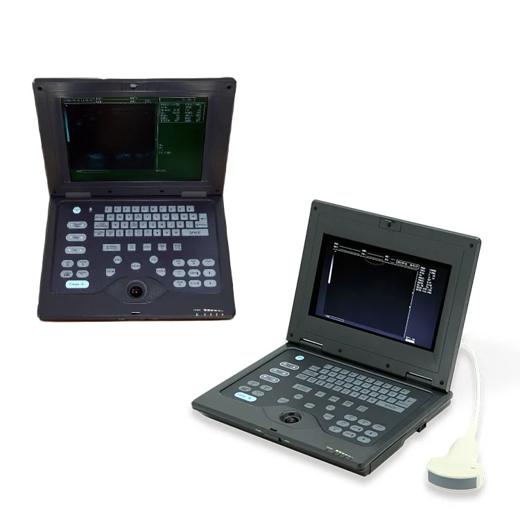 

With CE CONTEC CMS600P Palm size Ultrasound Fetus Machine Laptop Ultrasound Medical ultrasound instruments