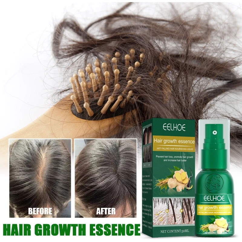 

Имбирная продукция от выпадения волос, сыворотка для быстрого роста, питание, смягчение кожи головы, Прямая поставка, 30 мл