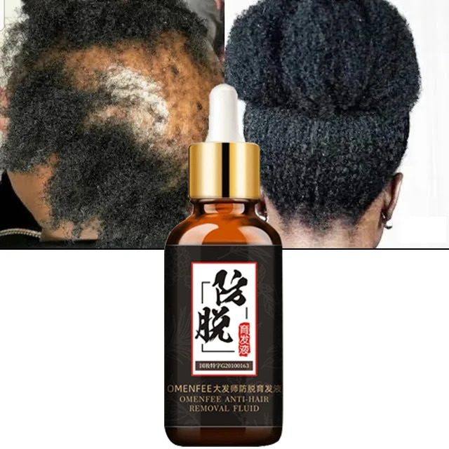 2pc Fast Hair Care Growth Sprays Essential Oil Beauty Dense Hair Growth Serum Essence Prevent Hair Loss Products Health Care