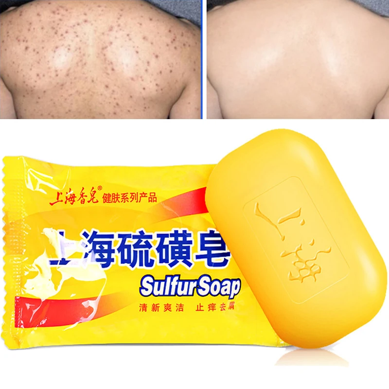 

85g Shanghai Sulfur Soap Sulphur soap Acne Treatment Psoriasis Seborrhea Eczema Anti Fungus Bath Healthy Soaps THYLOX BAR SOAP