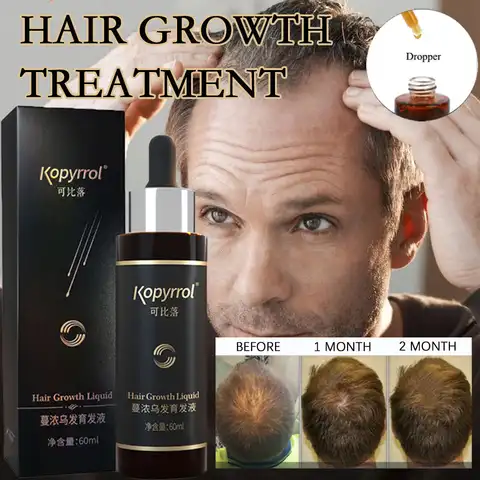 60 мл эссенция для роста волос сыворотка для роста густых волос для мужчин/женщин, мужчин, лечение выпадения волос, уход за кожей головы, имби...