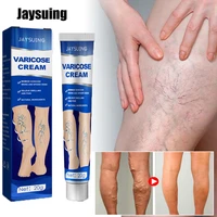 varicose veins treatment cream relieve dilated capillaries remove phlebitis spider leg antibacterial ointment body care products