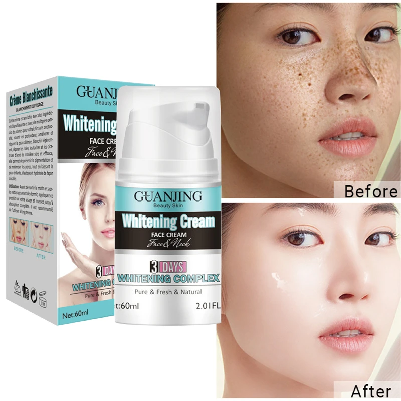 

Whitening Spot Cream Fade Niacinamide Dark Spots Facial Cream Shrink Pores Moisturizing Brighten Face Cream Skin Care Cosmetics
