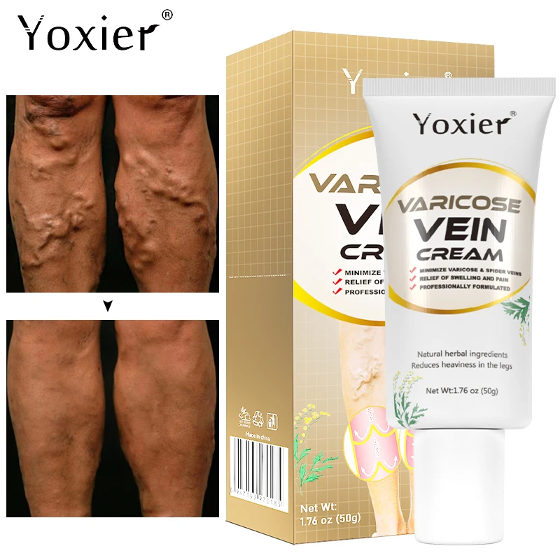 

Varicose Vein Repair Cream Vasculitis Phlebitis Massage Relieve Swelling Pain Nourish Emove Earthworm Leg Promotes Blood 50g