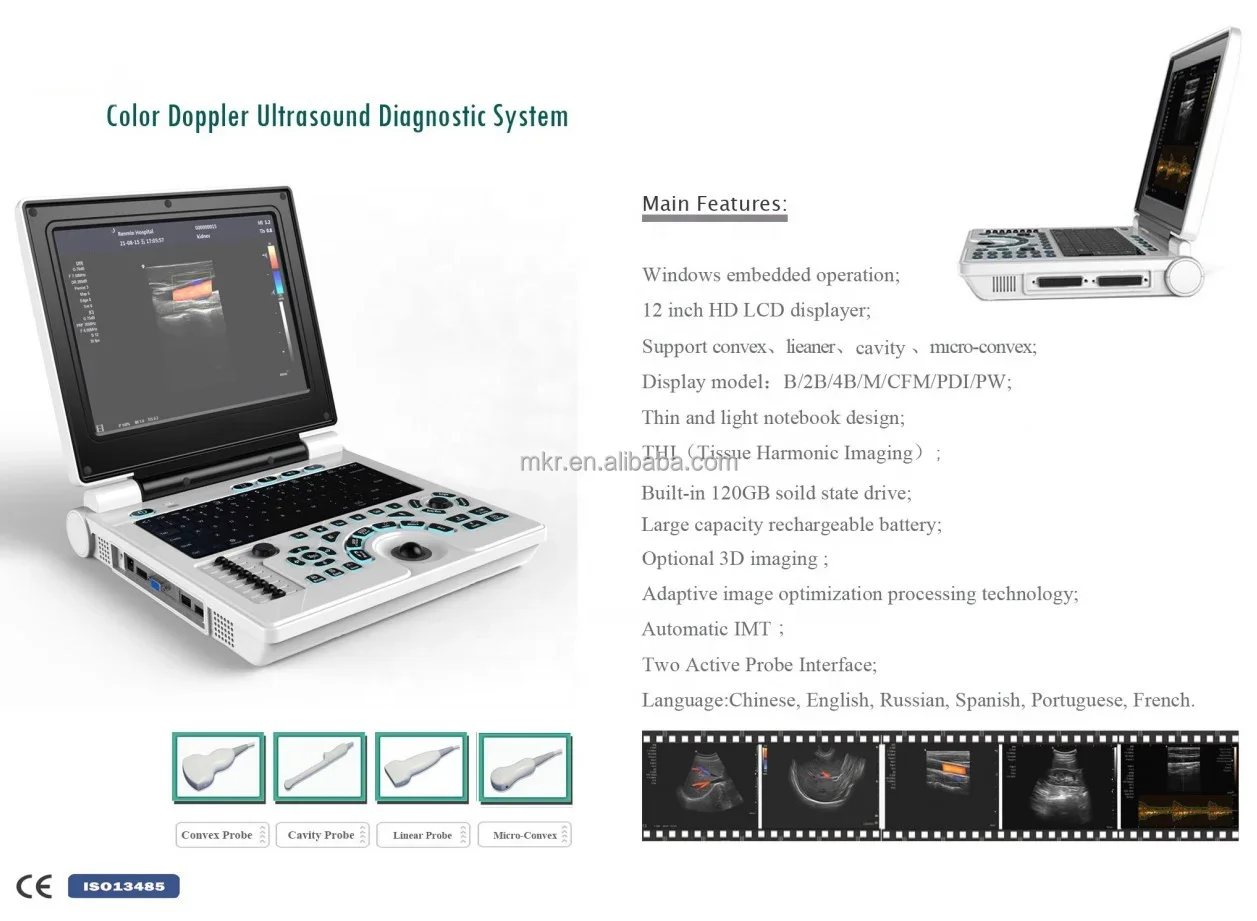 Медицинская кардиология портативный 12-дюймовый ультразвуковой аппарат цифровой