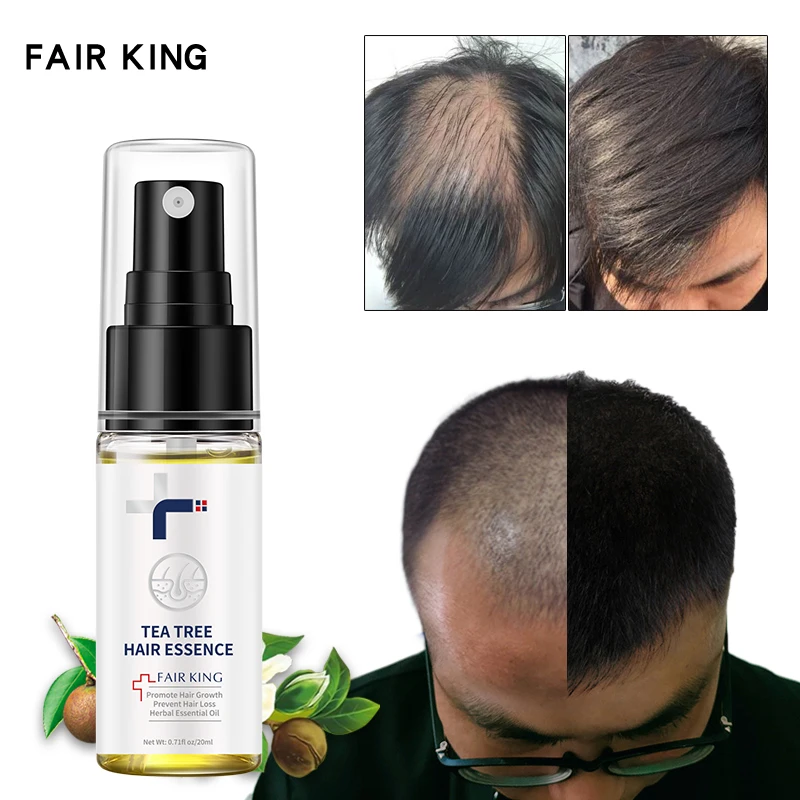 

Hair Growth Spray Serum Anti Hair Loss Products Fast Grow Prevent Hair Dry Frizzy Damaged Repair Dense Care Essential Oils