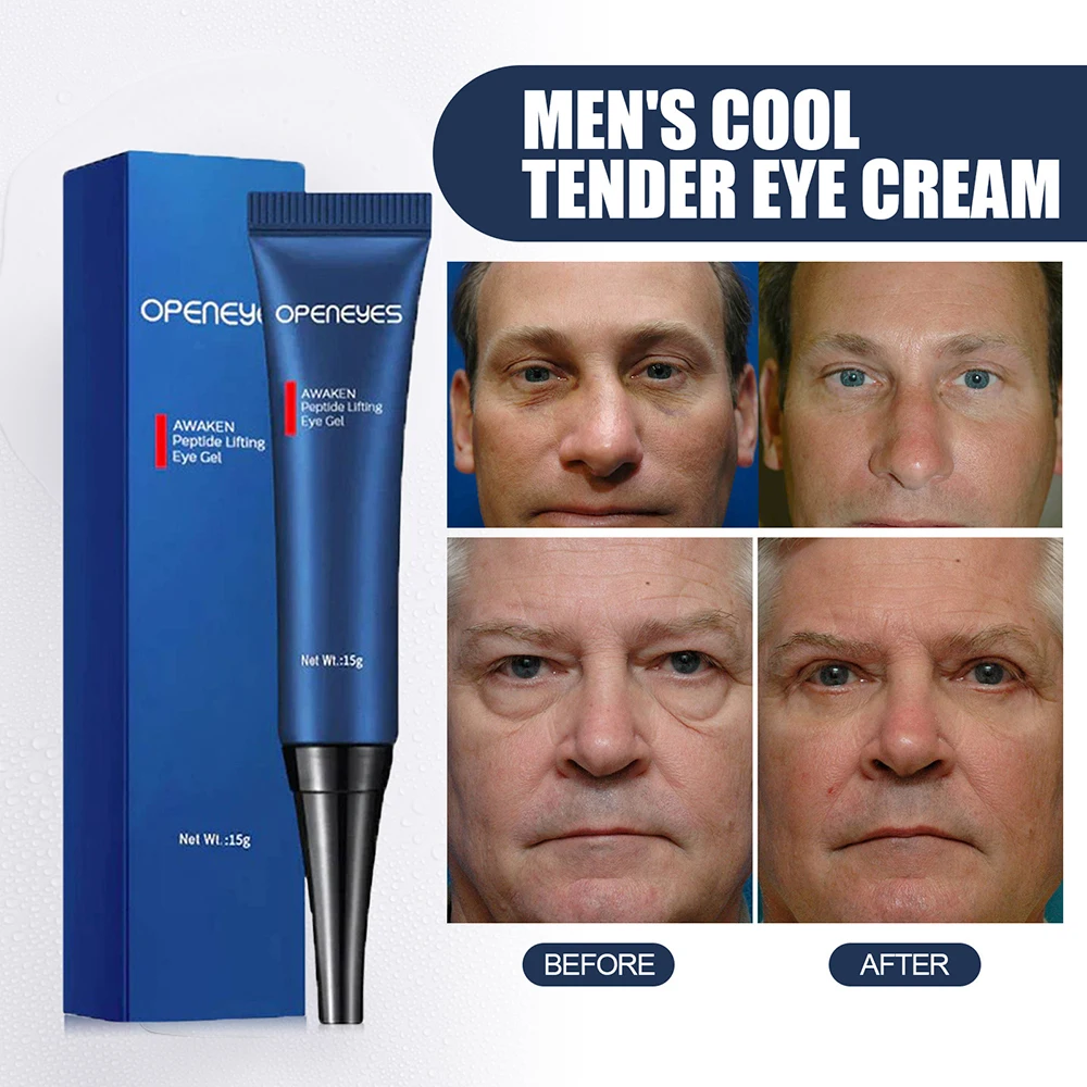 

Men Eye Cream Lighten Eye Fine Lines Lifting Tighten Eye Skin Anti Aging Eye Cream Repair Dark Care Cream Circles Eye Bag Eye