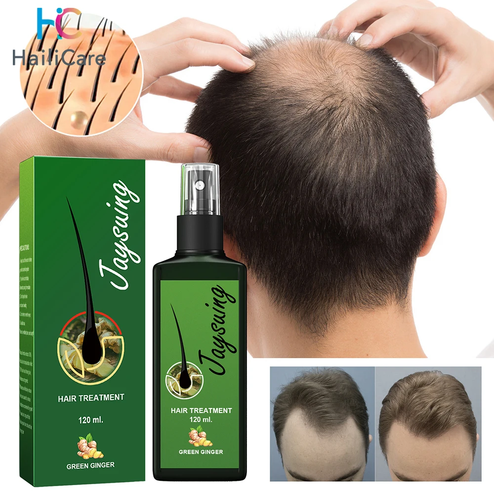 

Ginger Hair Growth Spray Serum For Anti Hair Loss Essential Oil Products Fast Treatment Prevent Hair Thinning Dry Frizzy Repair