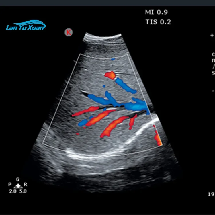 Рисунок 3 - Портативный цифровой цветной допплер