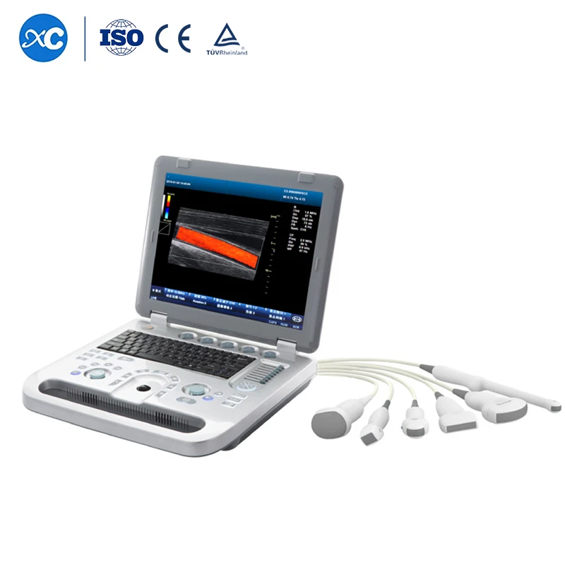 Ультразвуковой зонд Vscan Air диагностический беспроводной двойной машина для