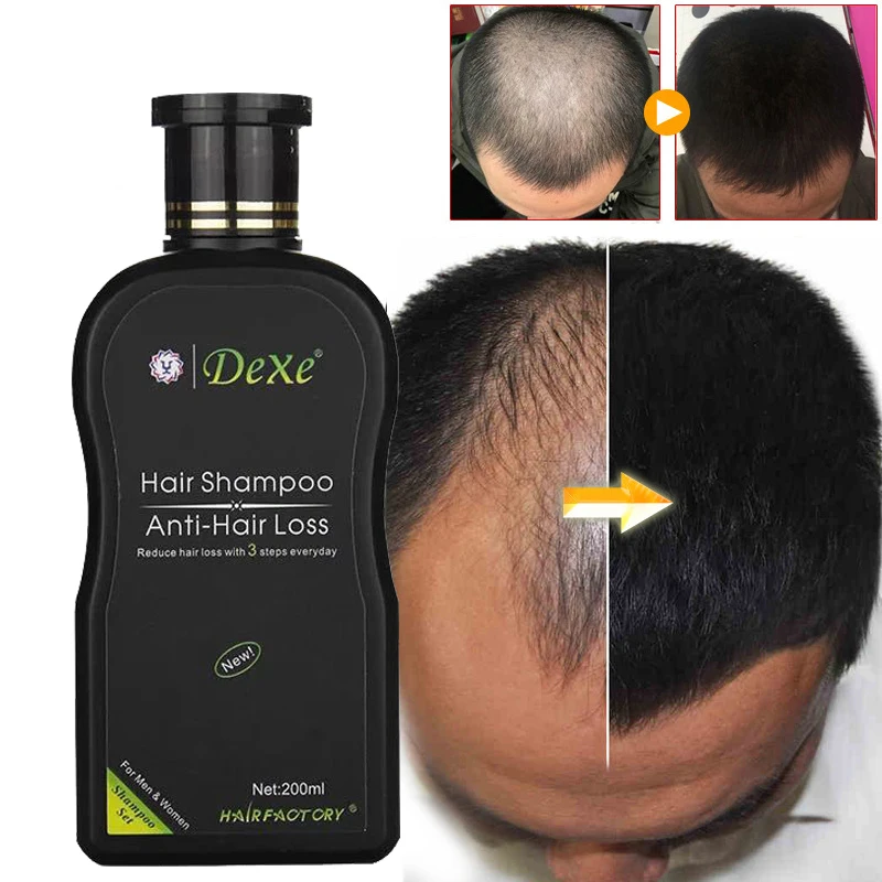 

Dexe профессиональный шампунь для роста волос против выпадения волос Китайский травяной продукт для роста волос предотвращает волосы для мужчин и женщин мужчин
