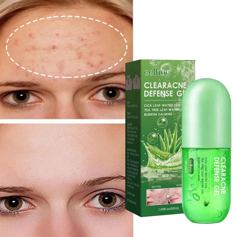 

Get Rid of Acne Fade Acne Marks Shrink Pores Facial Serum Moisturiz Repair Damaged Skin Brighten Skin Tone Hyaluronic Acid Gel