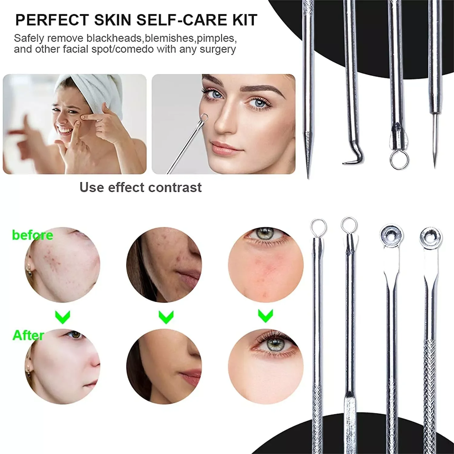 

4PCS Blackhead Acne Remover Comedone Black Spot Blemish Pimple Removal Needle Facial Care Skin Cleansing Pore Cleanser Beauty