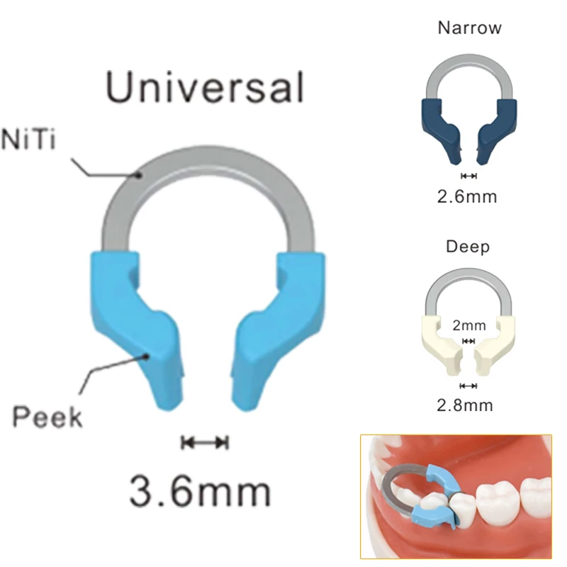 Стоматологические матричные ленты Niti металлические матрицы зажимное кольцо