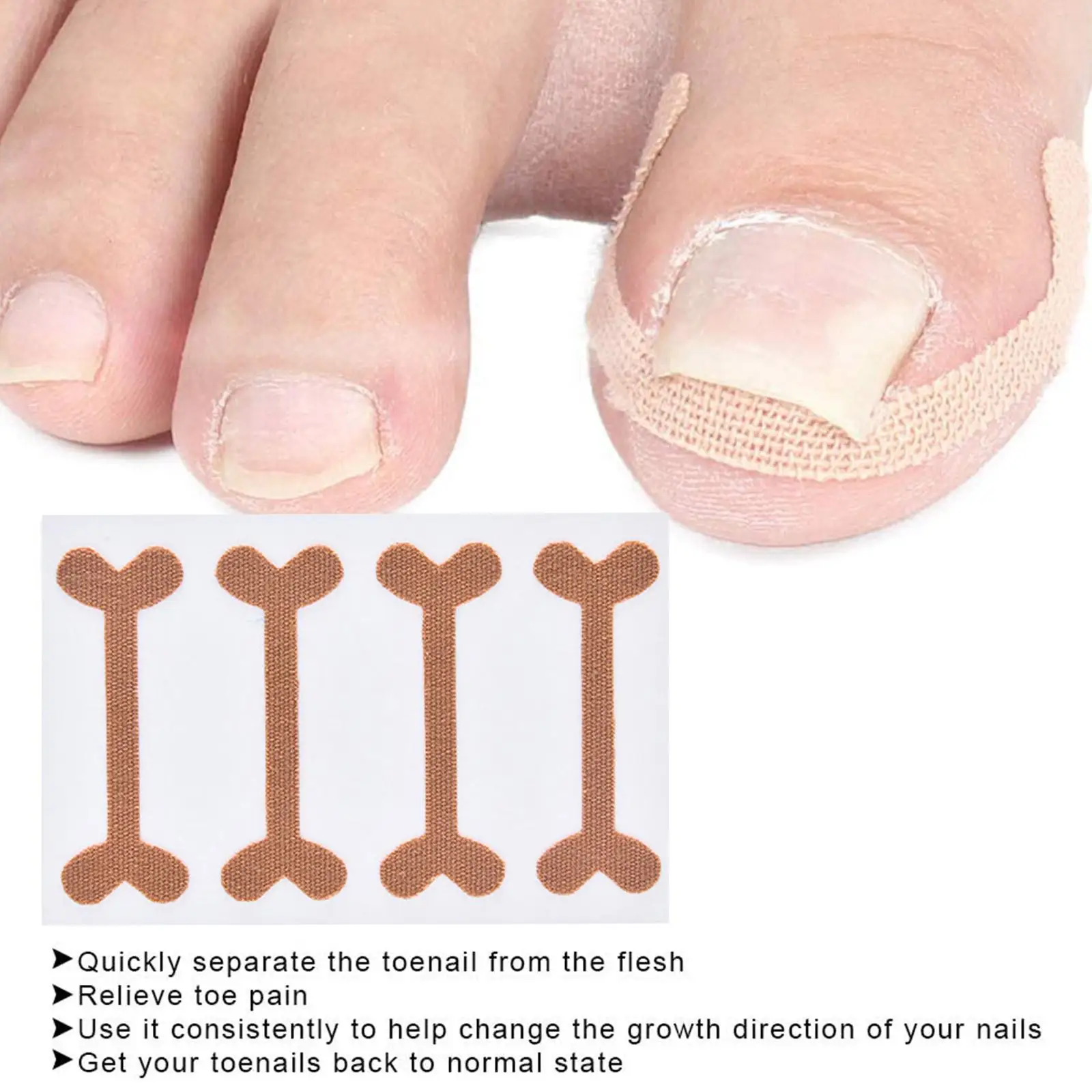 

Наклейка для коррекции вросших ногтей без клея, лечение паронихии, фиксатор восстанавливает кожу стопы, патчи для ногтей