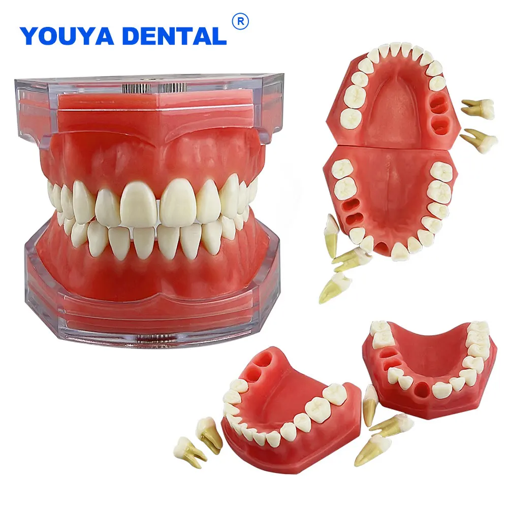 Dental Model Removable Teeth Model Detachable Implant Soft Gum Tooth Model Dentist Teaching Research Dentistry TYPODONT Model