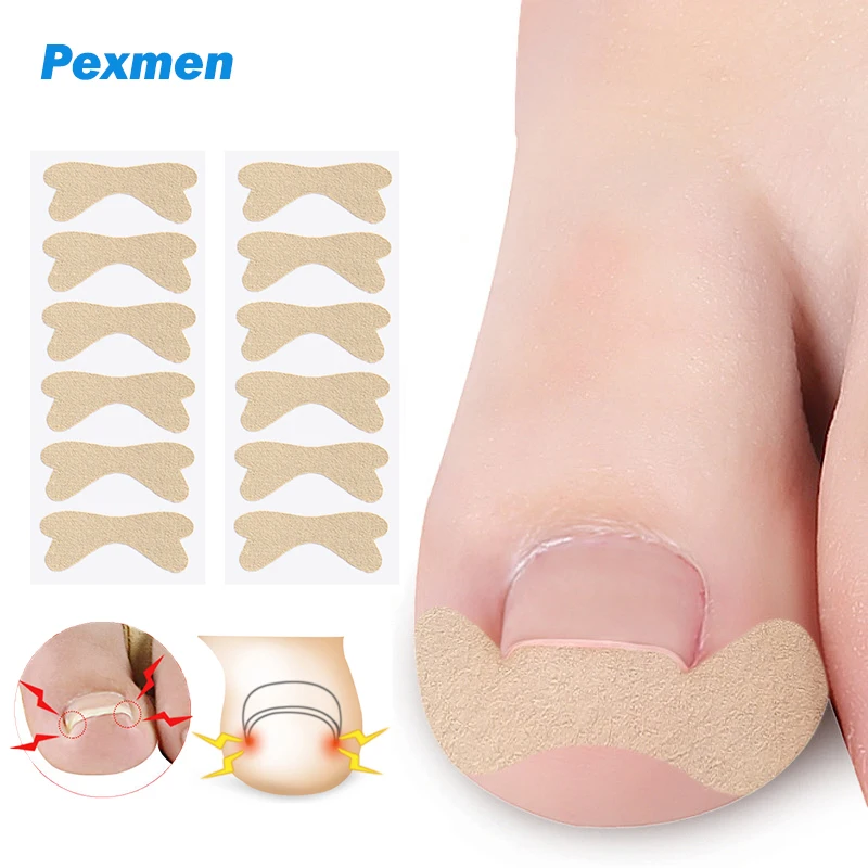 

Pexmen 6/12/30Pcs Ingrown Toenail Correction Sticker Adhesive Toenail Patch Elastic Nail Treatment Corrector Sticker
