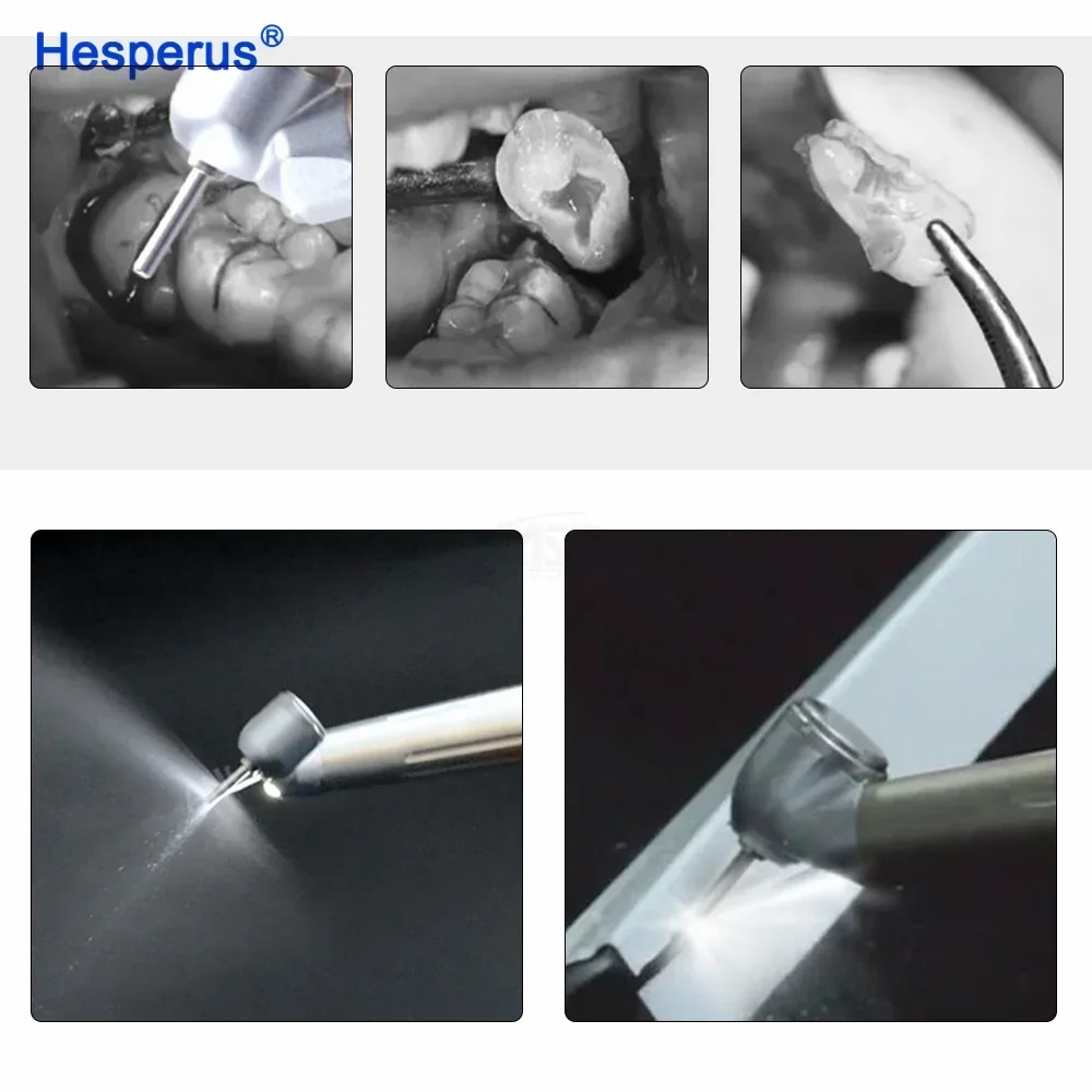 Asin Den tal 45-градусный анти-втягивающий хирургический светодиодный