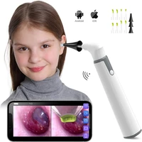 2pc wireless otoscope ear camera with dual view 3 9mm wifi ear scope with 6 led lights for kids and adults android and iphone
