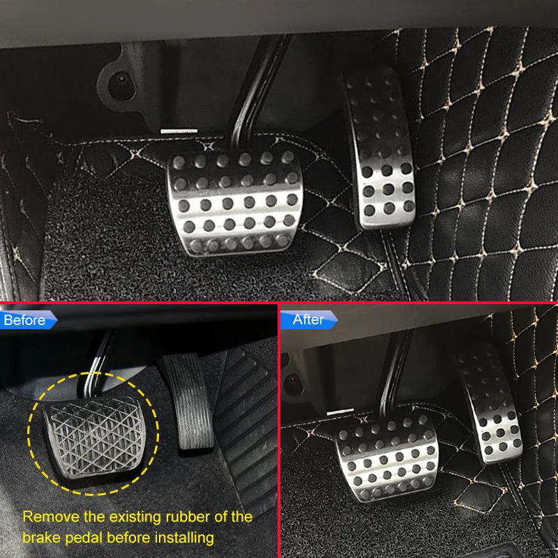 Automatic Brake Gas Pedal Covers Kit For Mercedes-Benz A B GLA CLA Class 2016 2017 2018 2019 | Pedals