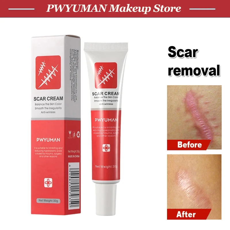 

Effective Scar Removal Cream Acne Scars Repair Gel Treatment Stretch Marks Surgical Scars Smooth Skin Care Ointment from Keloid