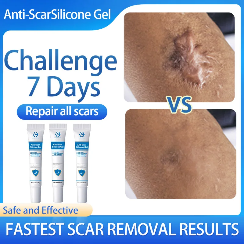 

Anti Scar Silicone Gel