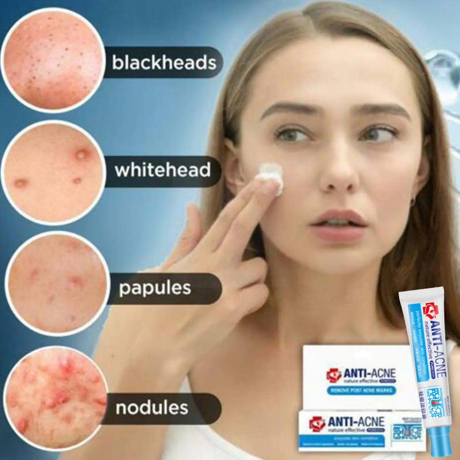 

30g Effective Acne Removal Cream Remove Melasma Fade Oil Cream Acne Moisturizing Shrink Whitening Freckle Pores Control Spo C0l2