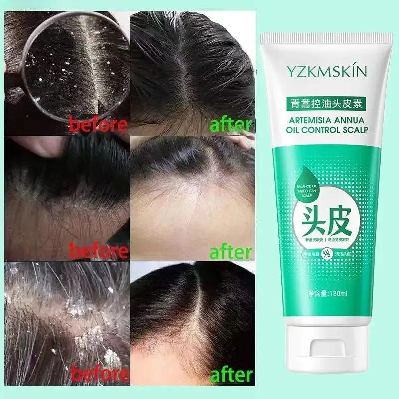 Artemisia Annua Oil Control Кондиционер для кожи головы 130 мл Очистка от перхоти Корни волос