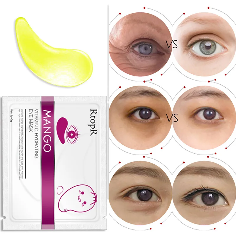 

RtopR 1pair Olive Mango Vitamin C Eye Patches Collagen Eye Mask To Remove Dark Circles Eye Bags Anti-wrinkle Gel Eye Pads