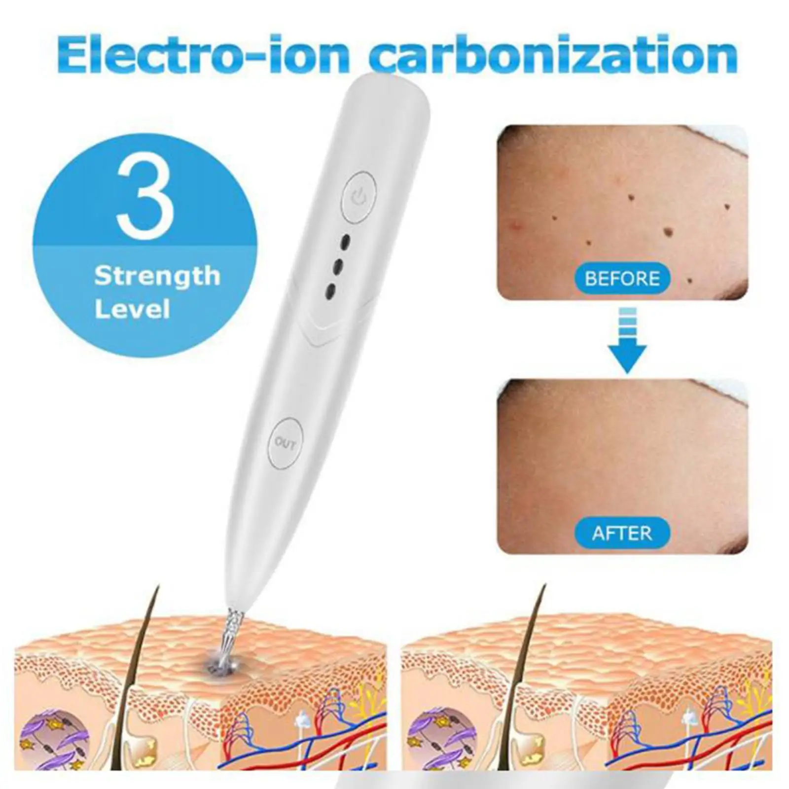 

Портативное средство для удаления бородавок с биркой для кожи, средство для удаления бородавок, машинка для легкого использования, професс...