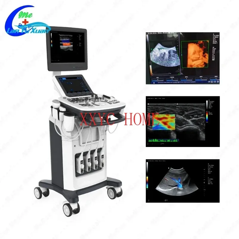 Ecografo цифровая кардиографическая ультразвуковая машина Цветной Допплер 3d 4d