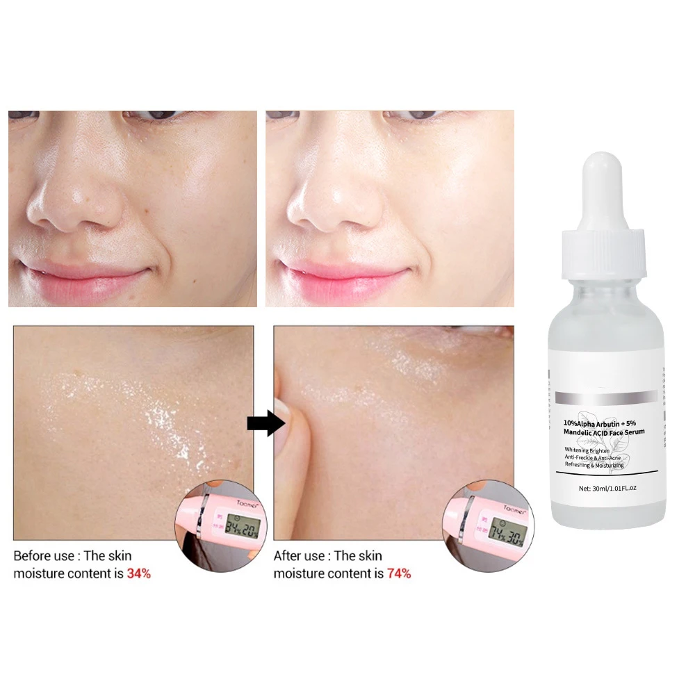 Фото 10% альфа-арбутин 5%Mandelic AClD сыворотка для лица натуральная мандельная кислота антивозрастная альфа-арбутин отбеливающая увлажняющая сыворотка для лица №3