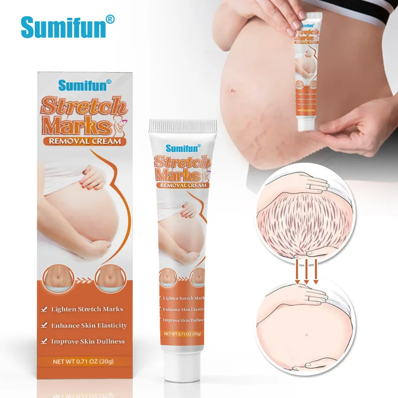 

Pregnancy Repair Cream Body Creams Treatments Firming Removes Stretch Mark Cream Scar Removal Cream Anti-aging Anti-winkles